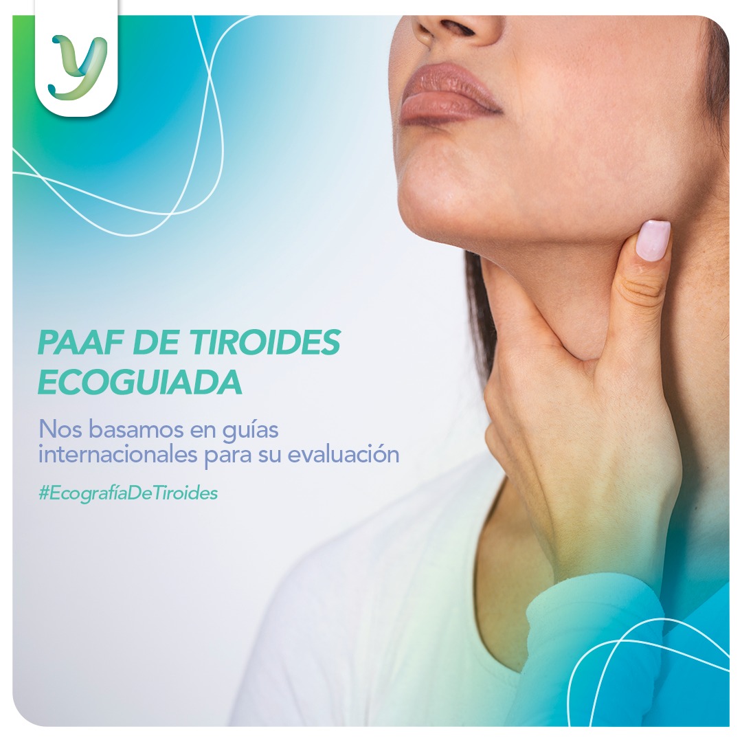 Nodulos